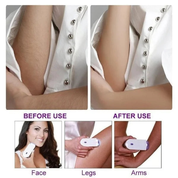 Portable Hair Removal Machine