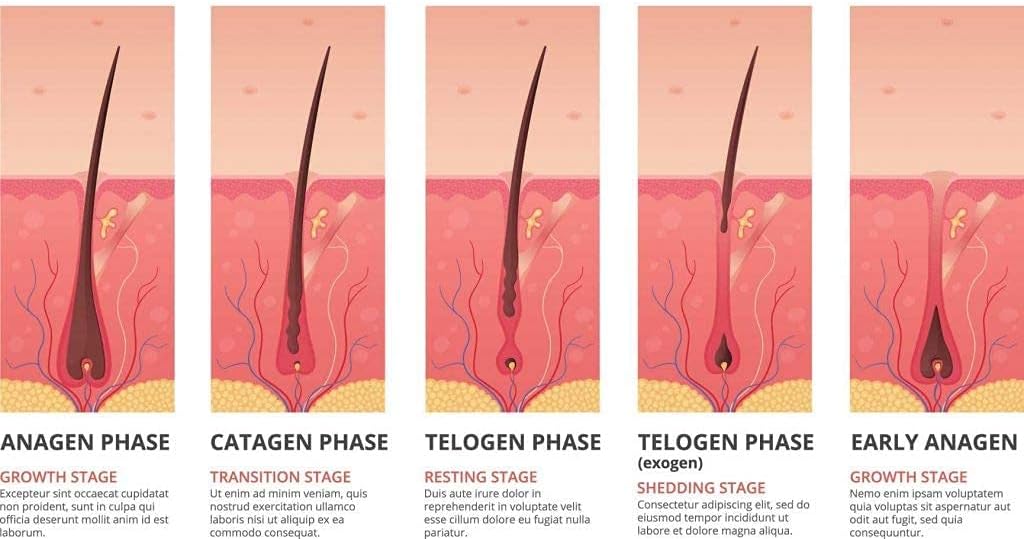 MINI LASER HAIR REMOVAL