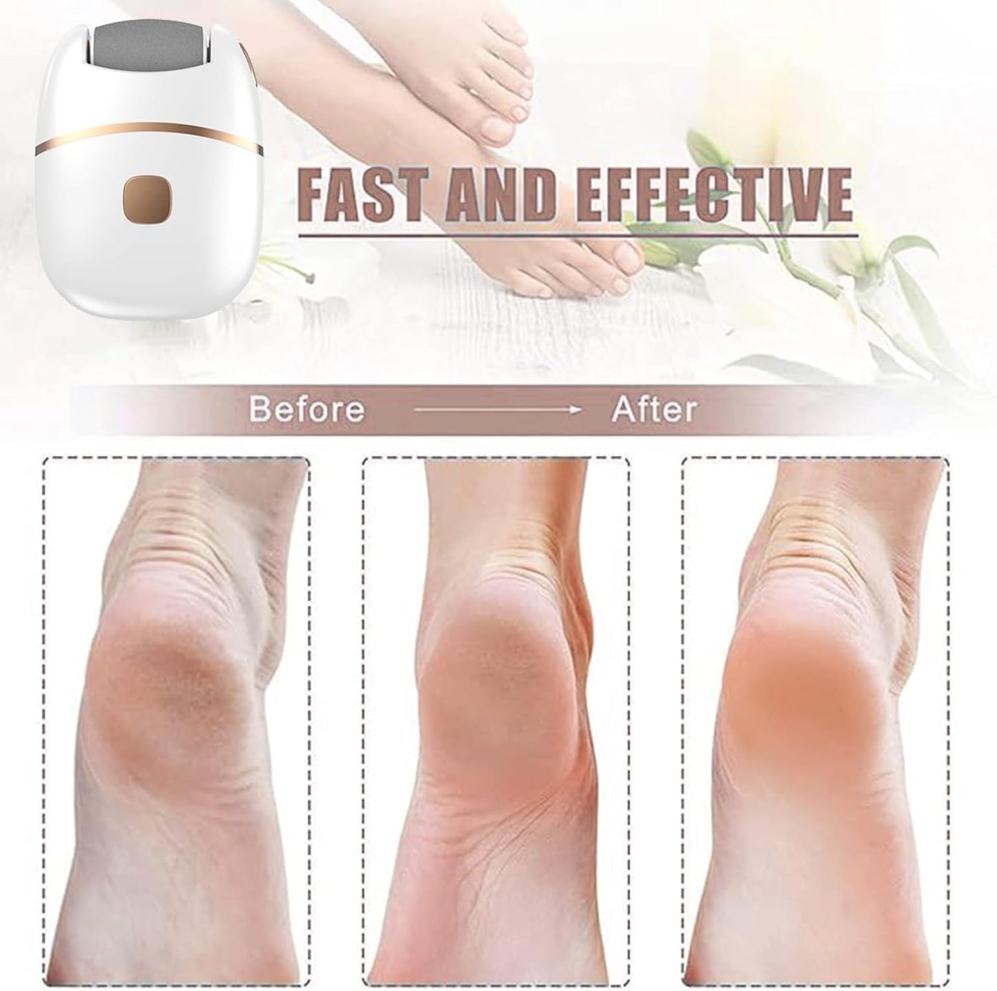 Rechargeable Electric Foot Grinder